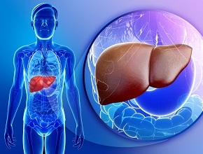 paciente con cirrosis hepática